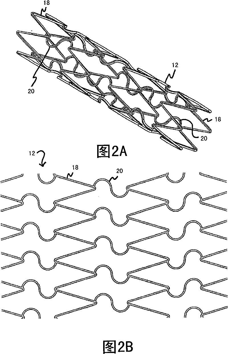 Aneurysm treatment system, device and method