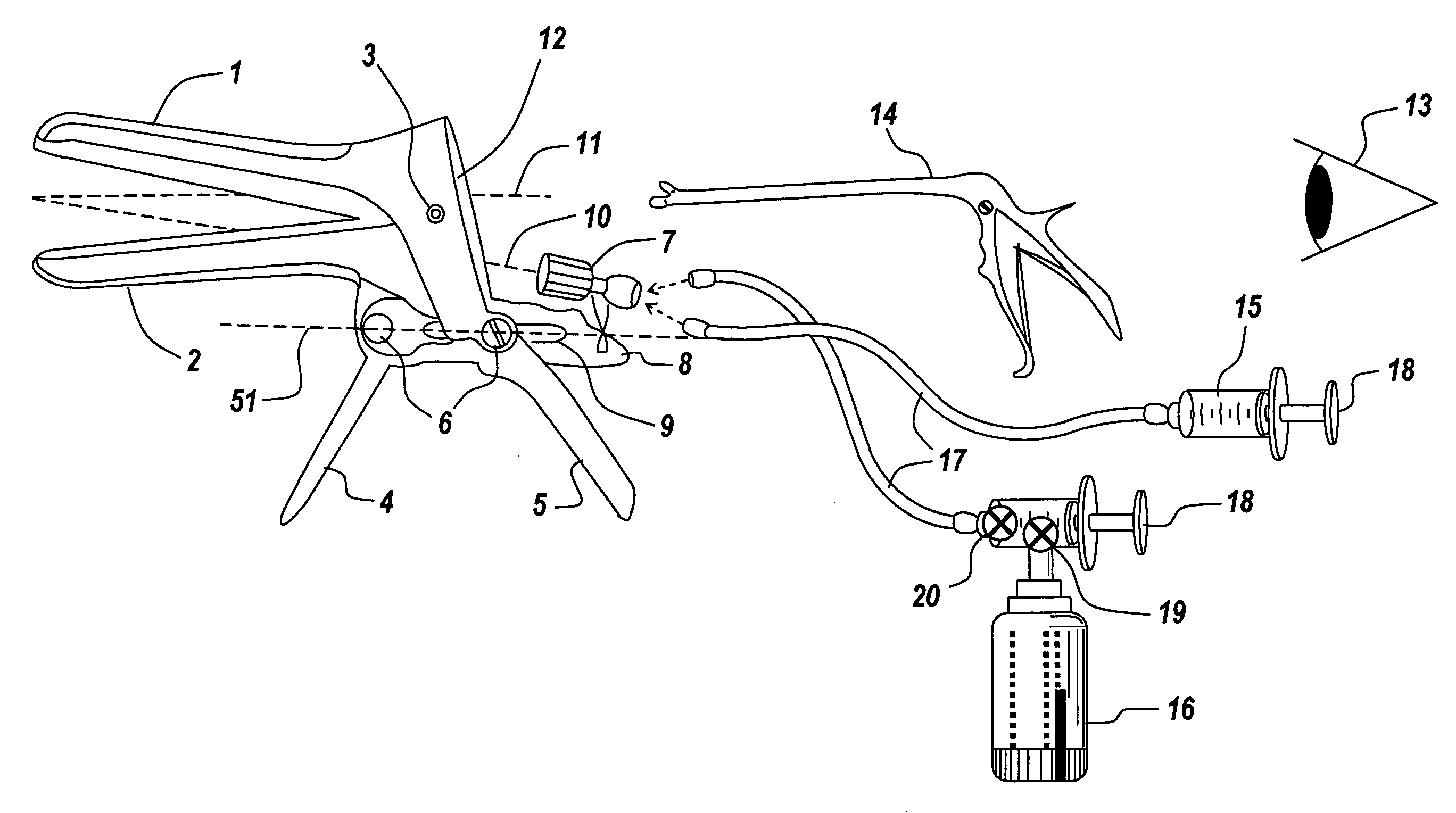 Vaginal speculum arrangement