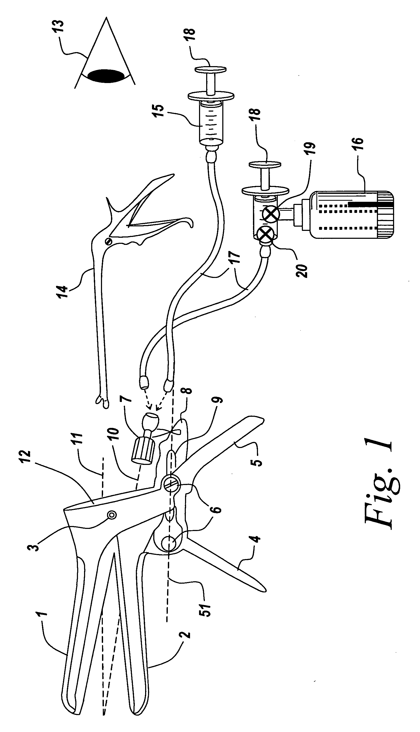 Vaginal speculum arrangement