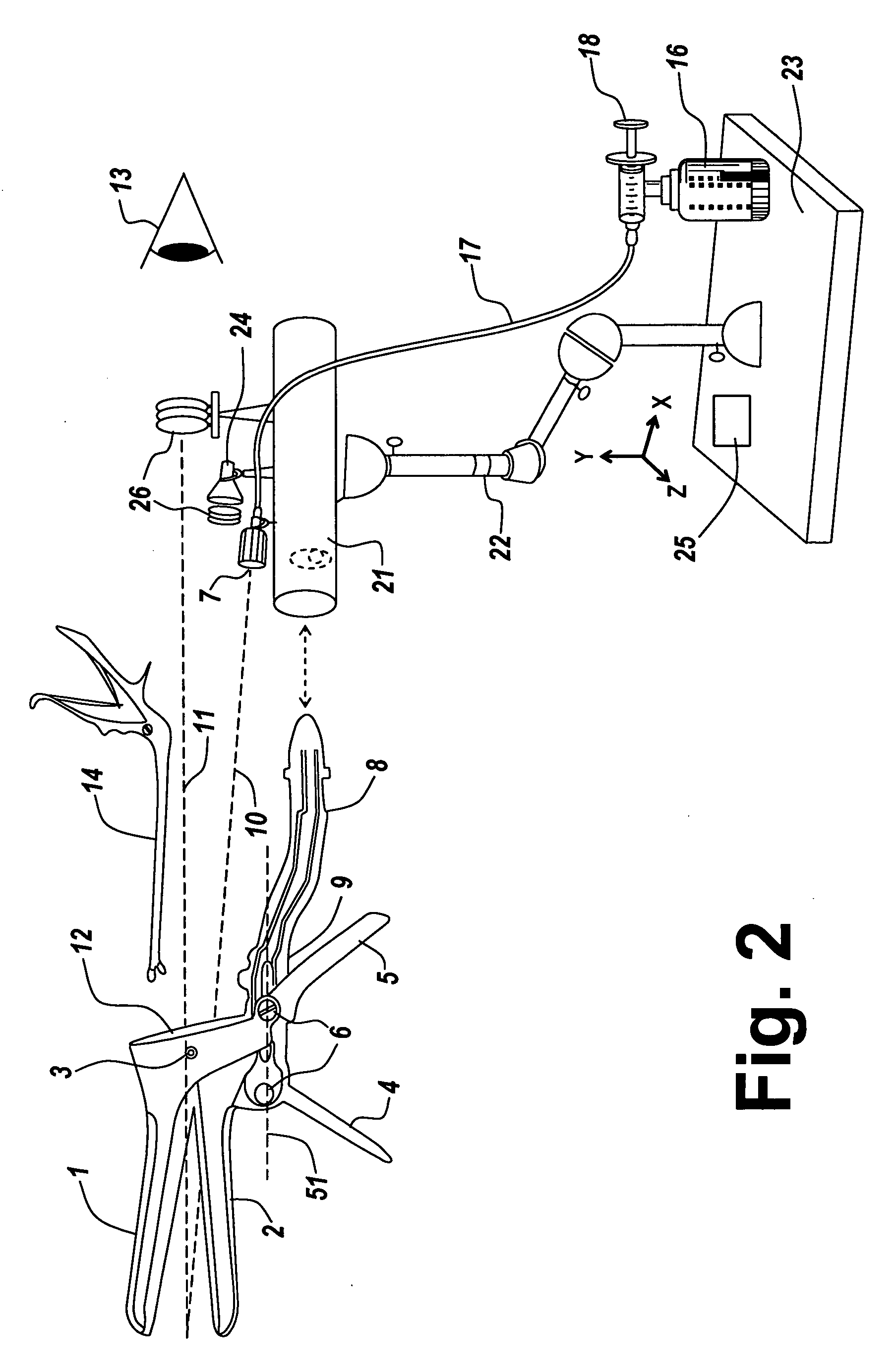 Vaginal speculum arrangement