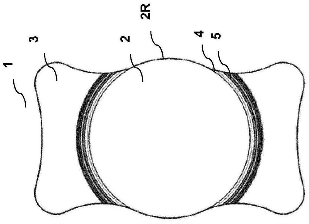 Ophthalmological implant and method for the production of same