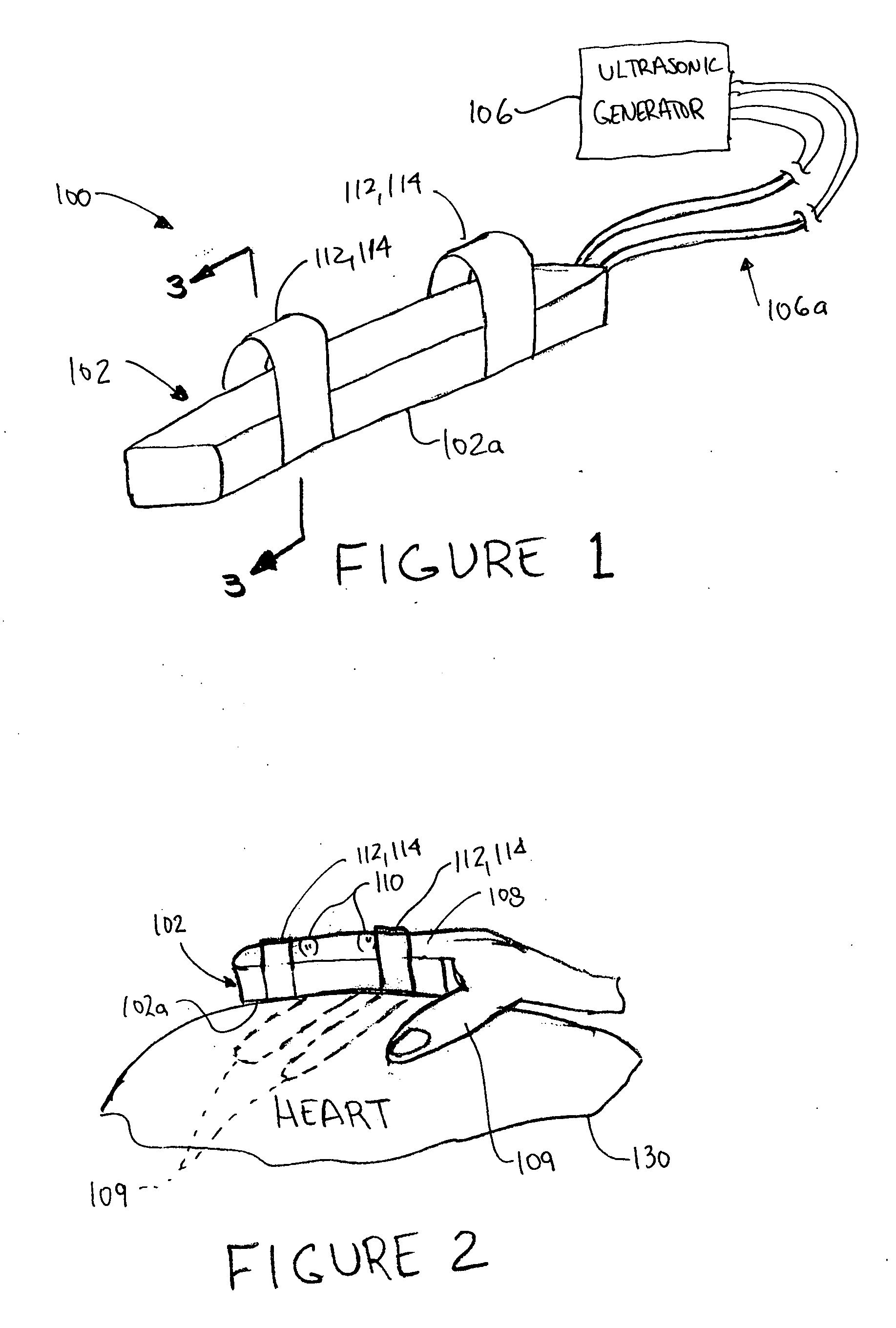 Ultrasonic finger probe