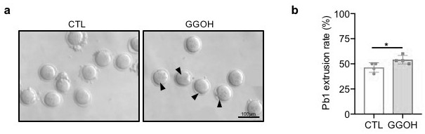 Application of mevalonic acid metabolic intermediate product in preparation of medicines for improving aging ovarian oocyte quality and meiosis process