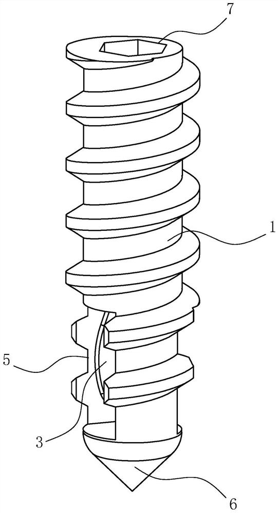 Anchor with suture