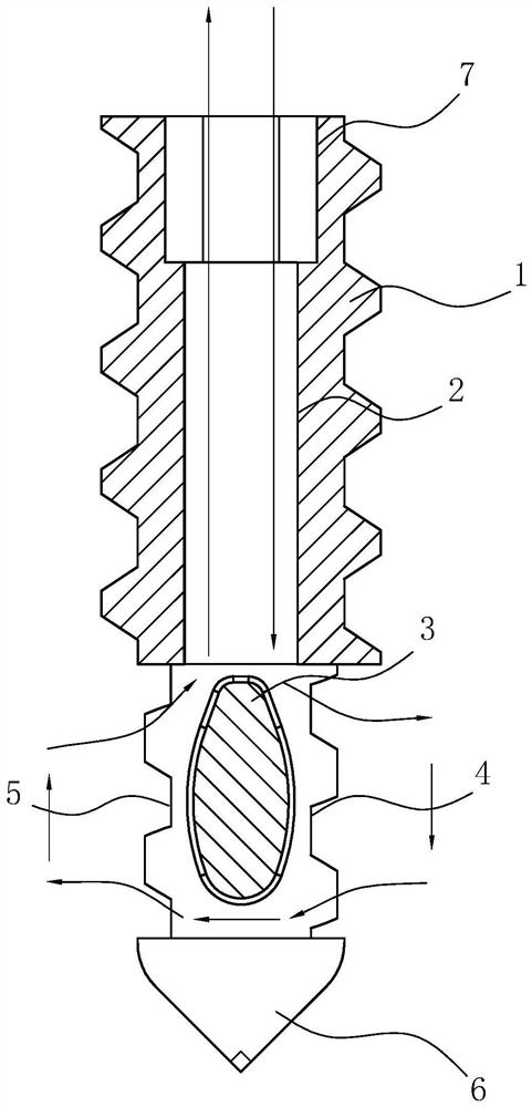 Anchor with suture