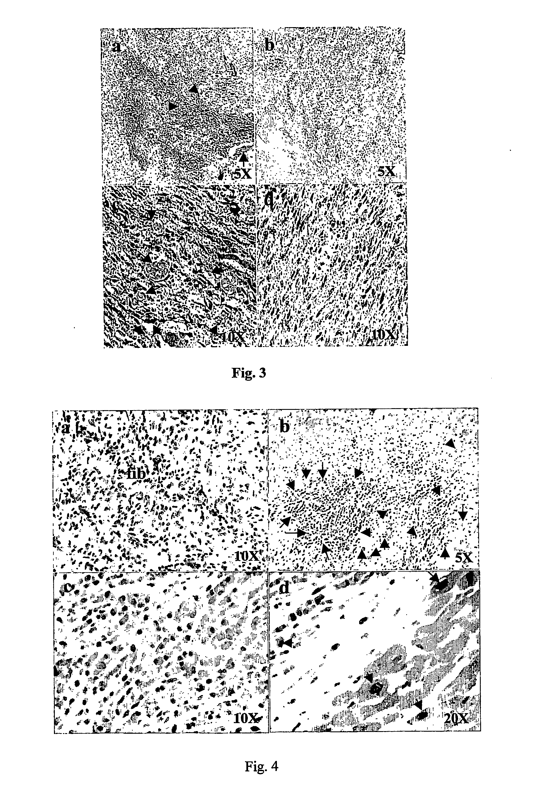 Compositions comprising organic extracts of geum japonicum thunb var. and the use thereof