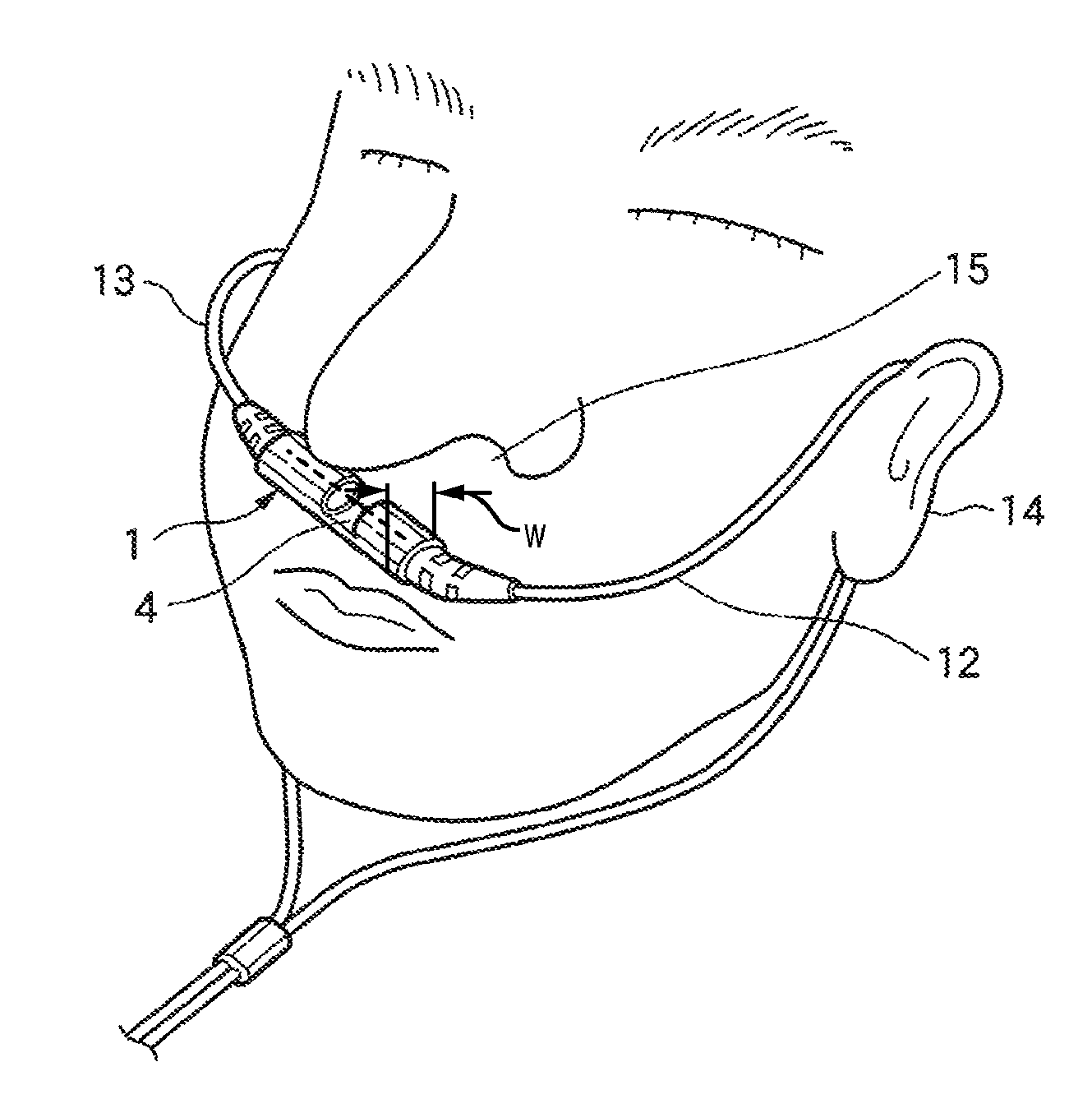 Sensor for measuring carbon dioxide in respiratory gas