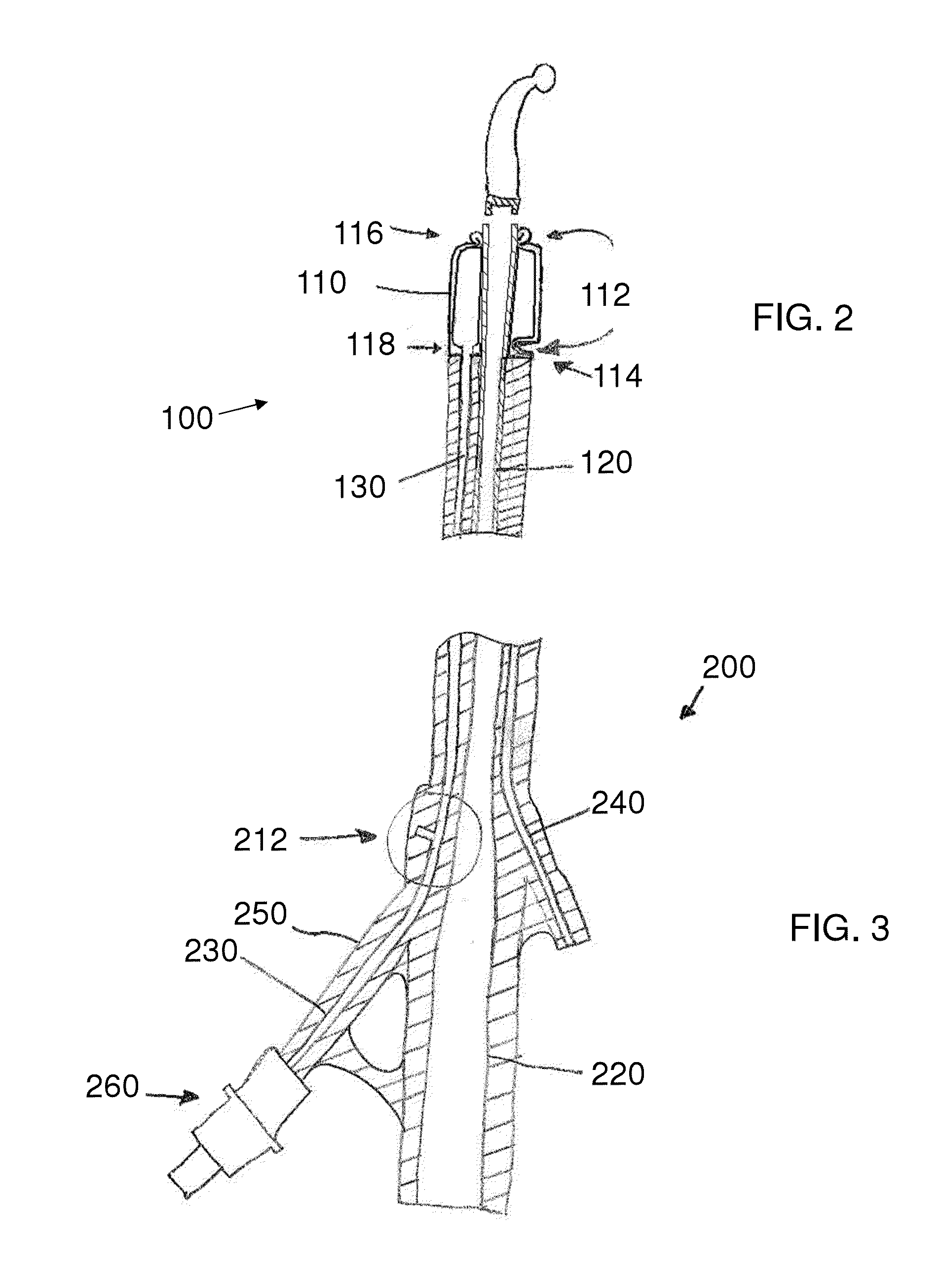 Stretch Valve Balloon Catheter and Methods for Producing and Using Same