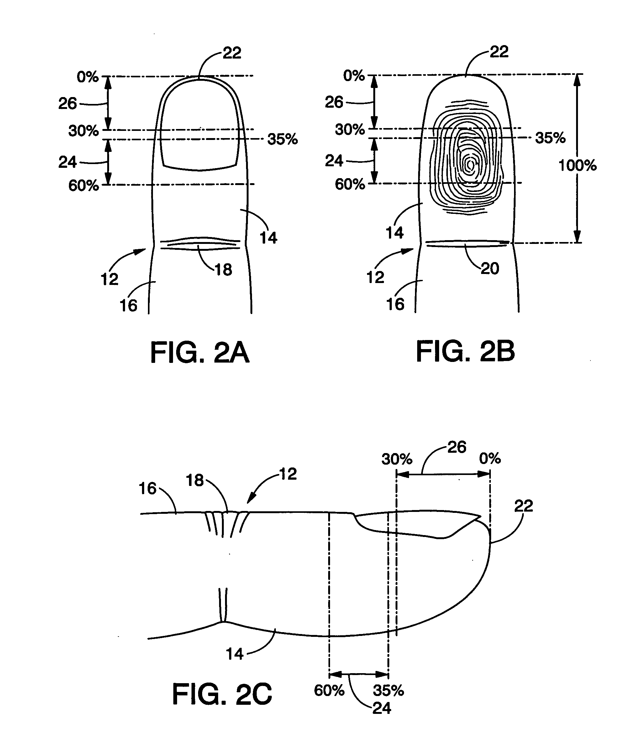 Pulse oximetry sensor and technique for using the same on a distal region of a patient's digit