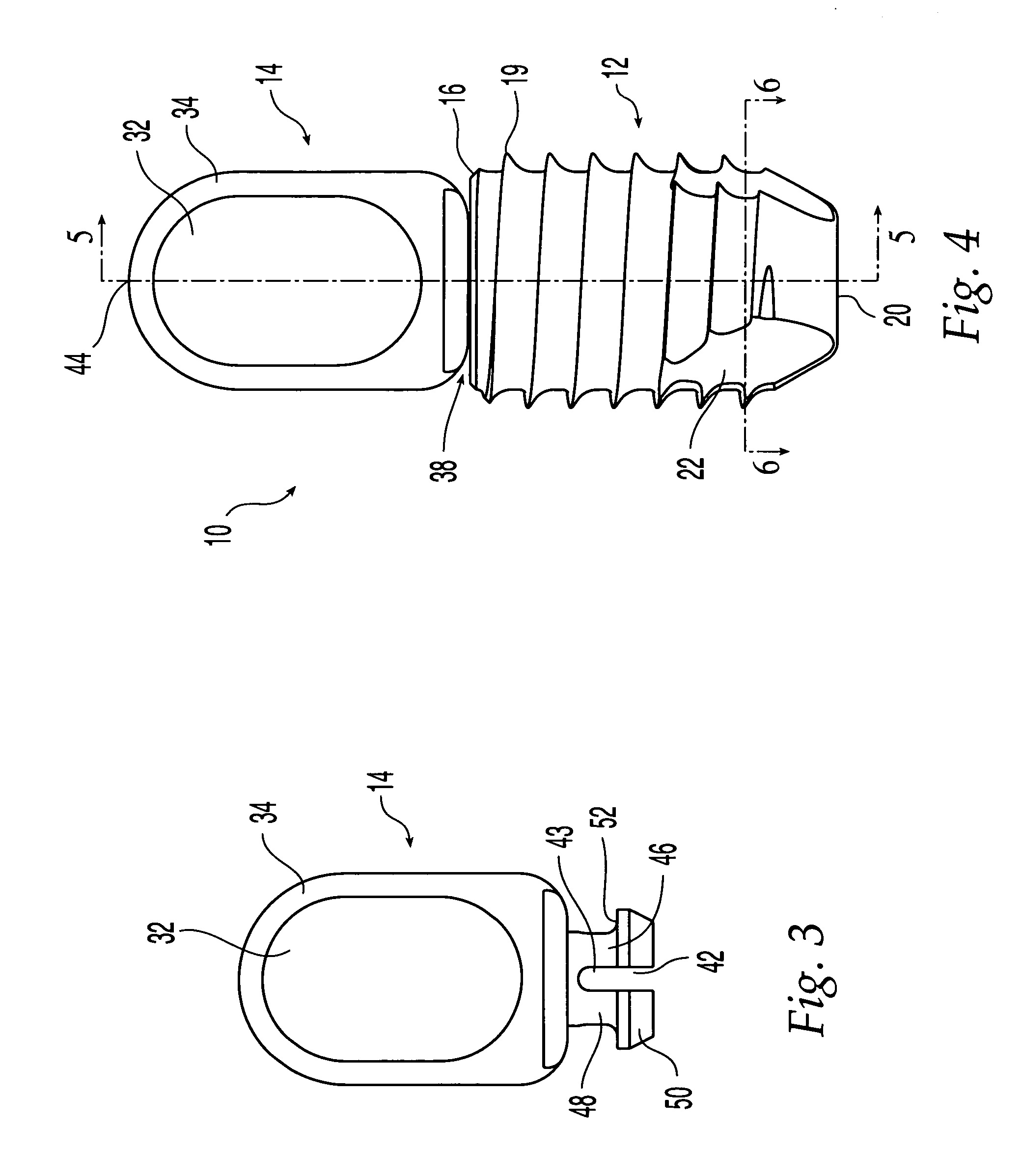 Graft fixation system and method