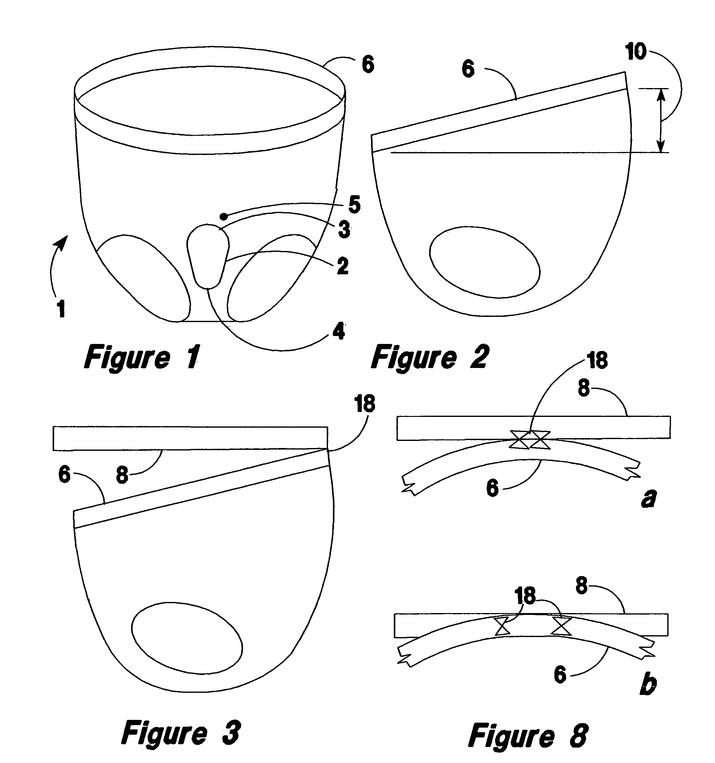 Undergarment for hernia relief and other purposes