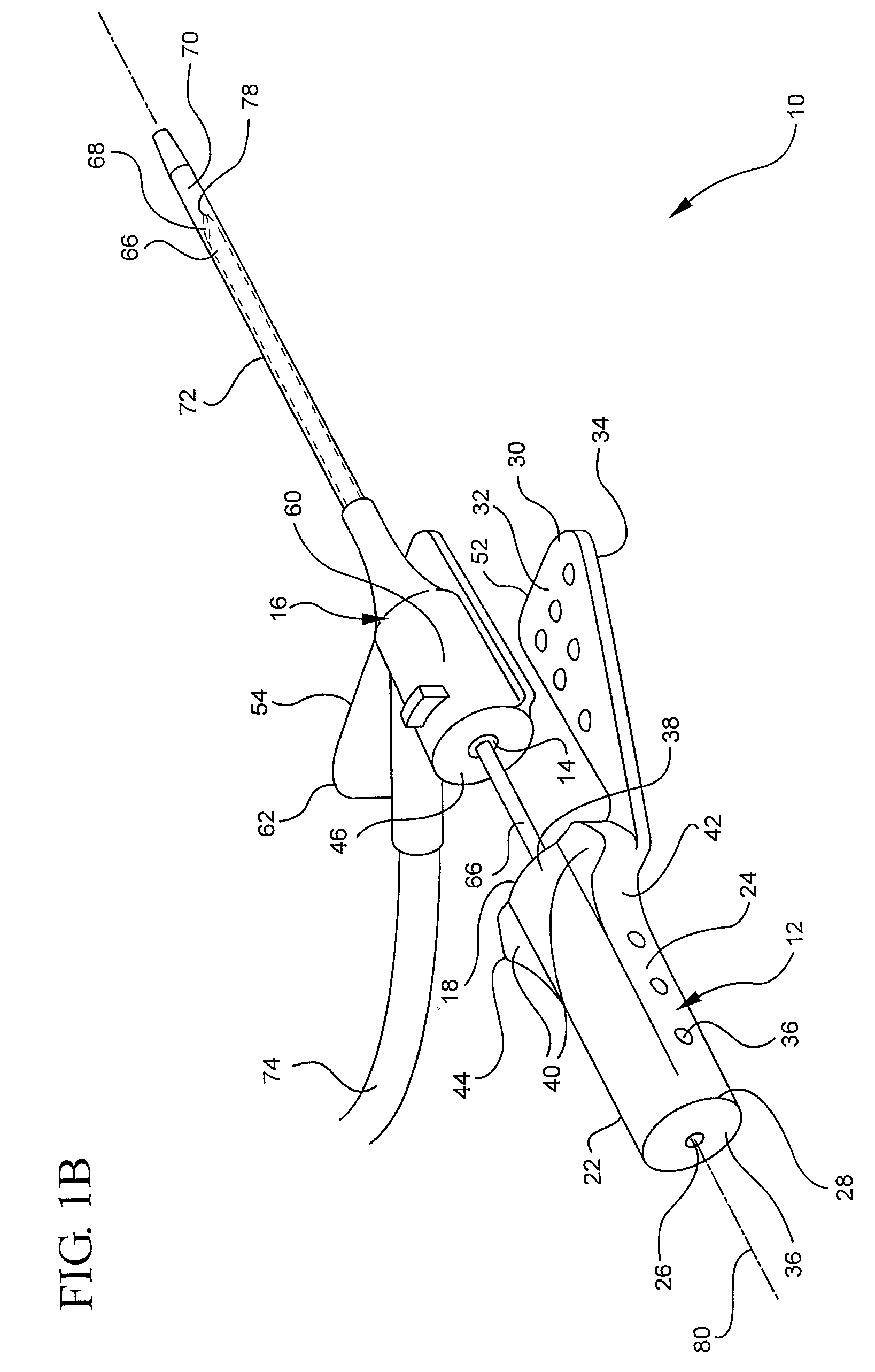 Systems and methods for providing a conventional integrated catheter with universal grip