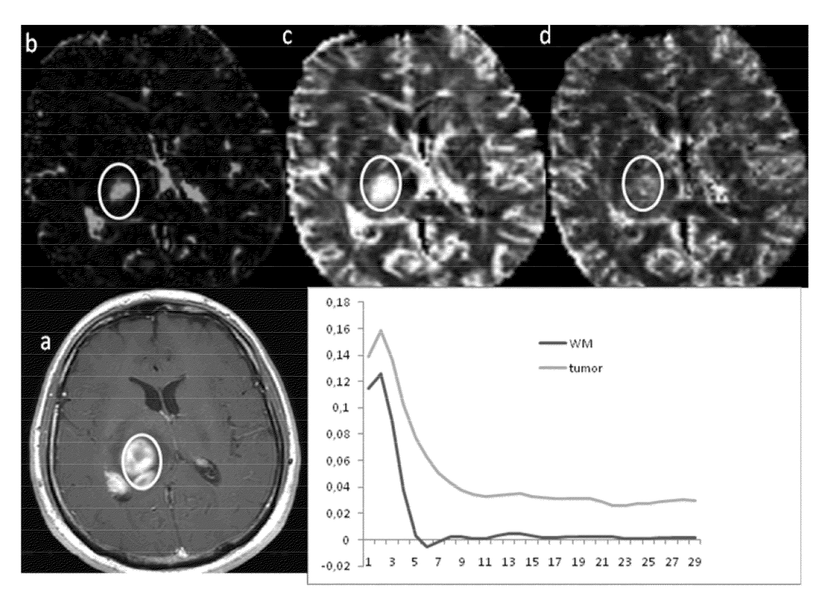 Estimating and correcting for contrast agent extravasation in tissue perfusion imaging