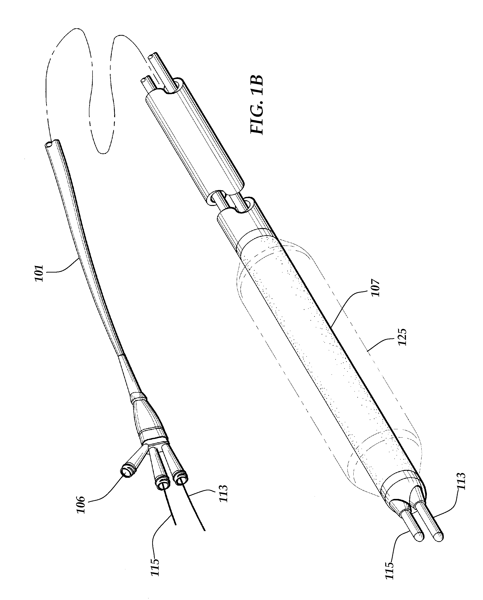 Apparatus and method for treatment of bifurcation lesions