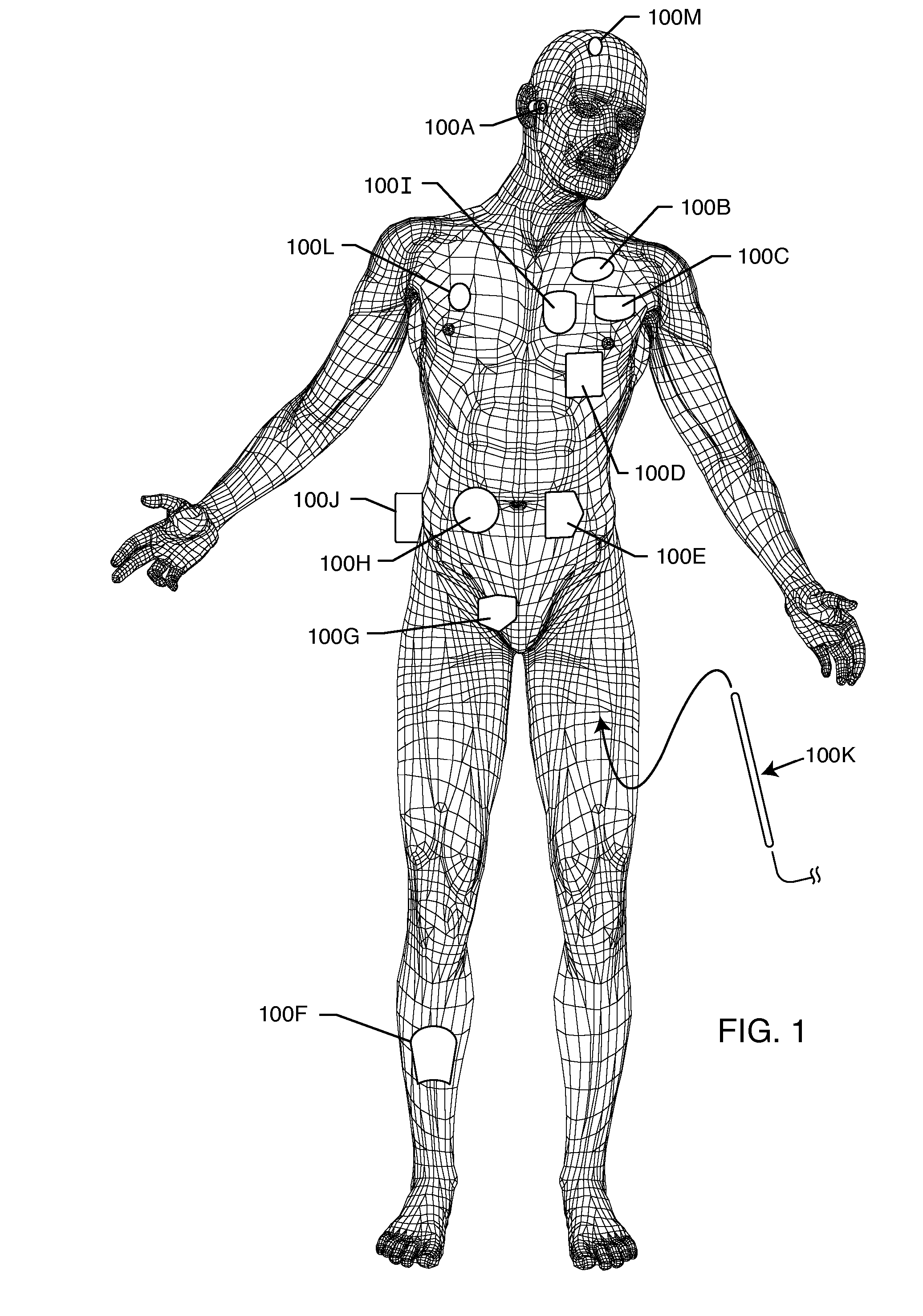 Non-ferromagnetic tank filters in lead wires of active implantable medical devices to enhance MRI compatibility