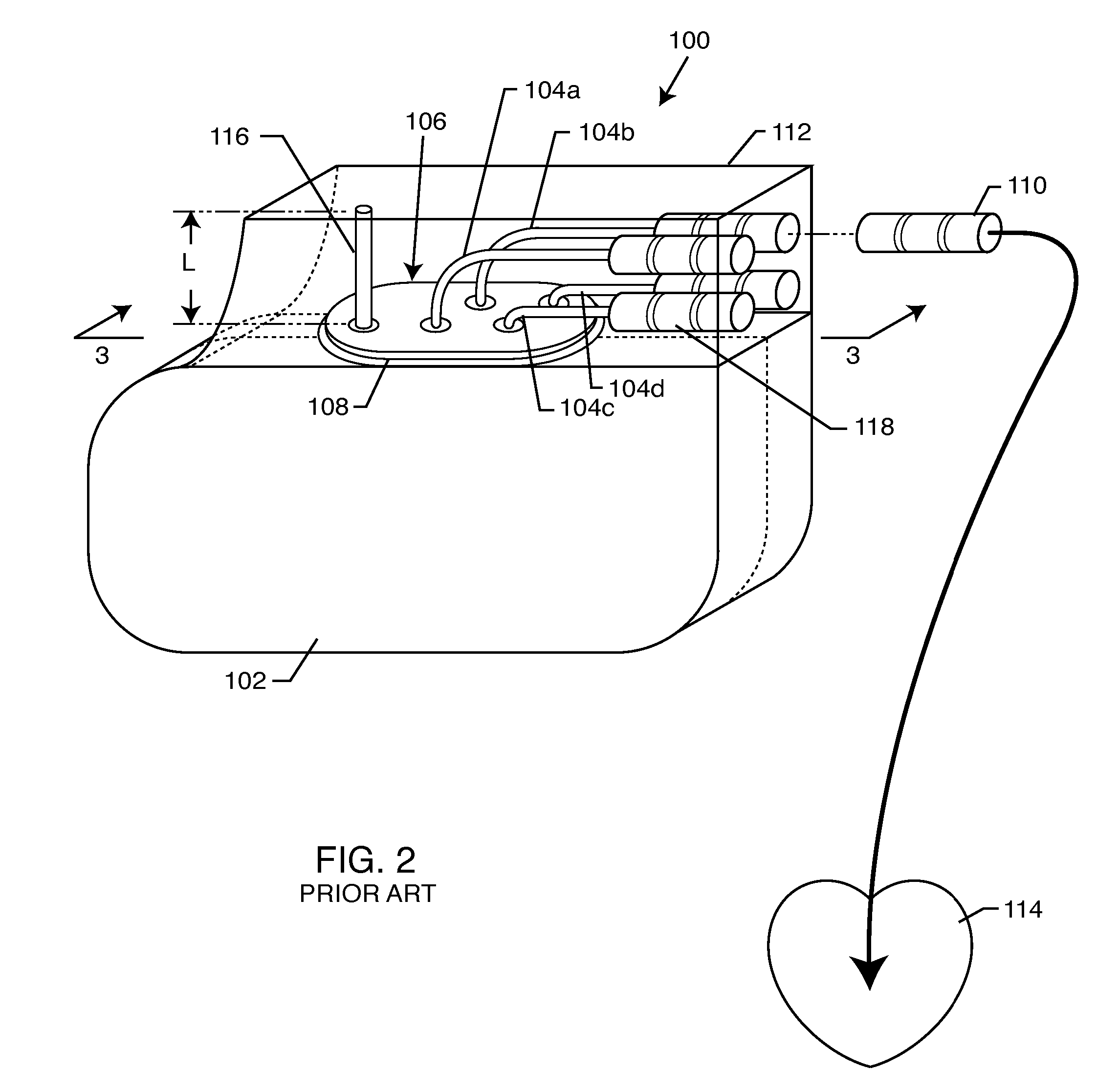 Non-ferromagnetic tank filters in lead wires of active implantable medical devices to enhance MRI compatibility