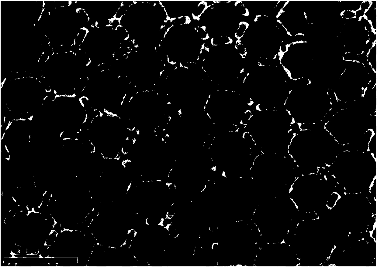 Preparation of SERS substrate and application of SERS substrate to cancer detection