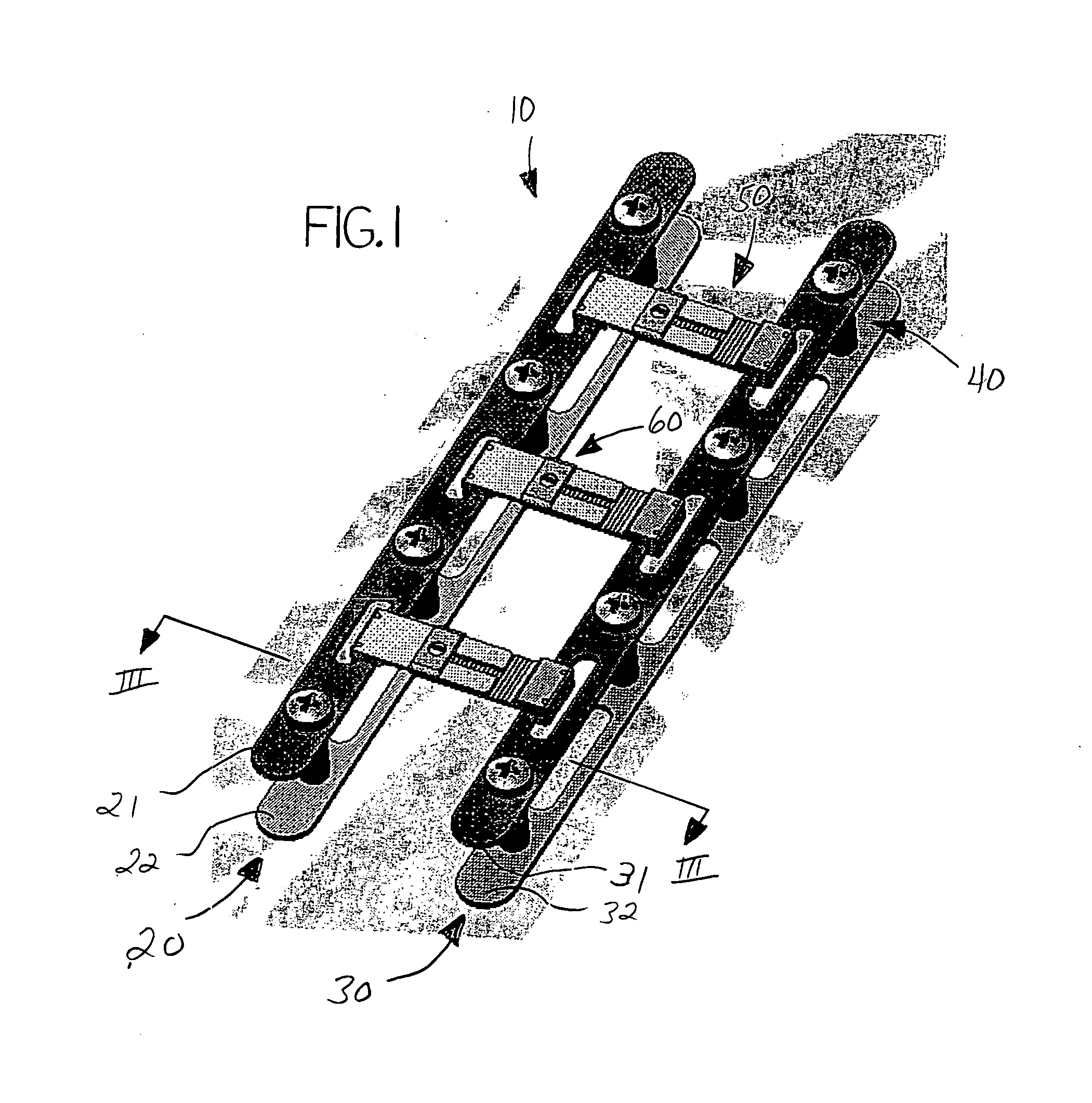 Sternal closure device