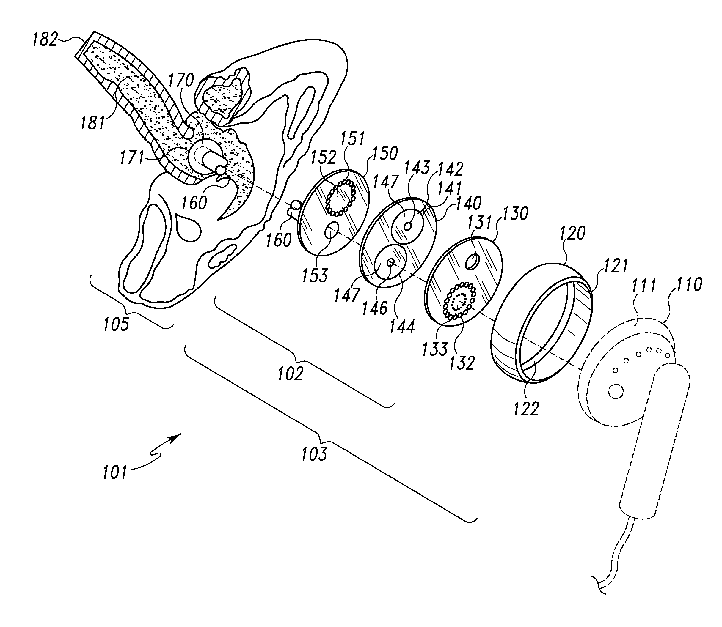 Diaphonic acoustic transduction coupler and ear bud