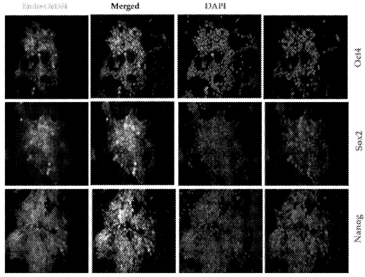 Microvesicle and stem cell compositions for therapeutic applications