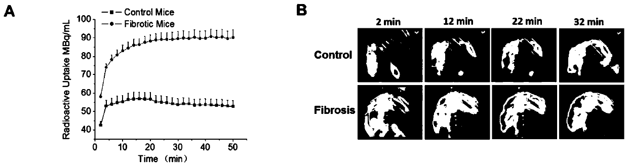 A kind of nuclide-labeled targeting probe compound and preparation method thereof