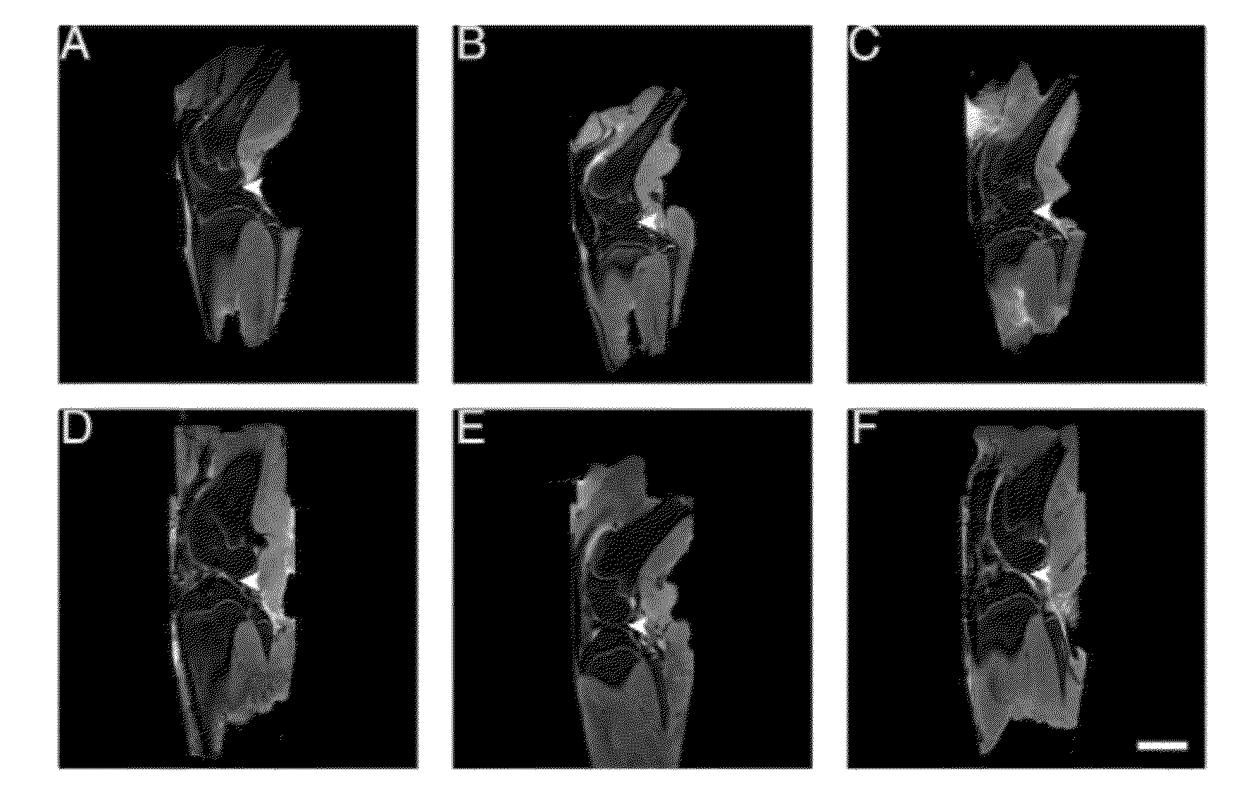 Dual antagonism of endothelin type a and bradykinin b1 receptors for treating pain and preventing cartilage degradation