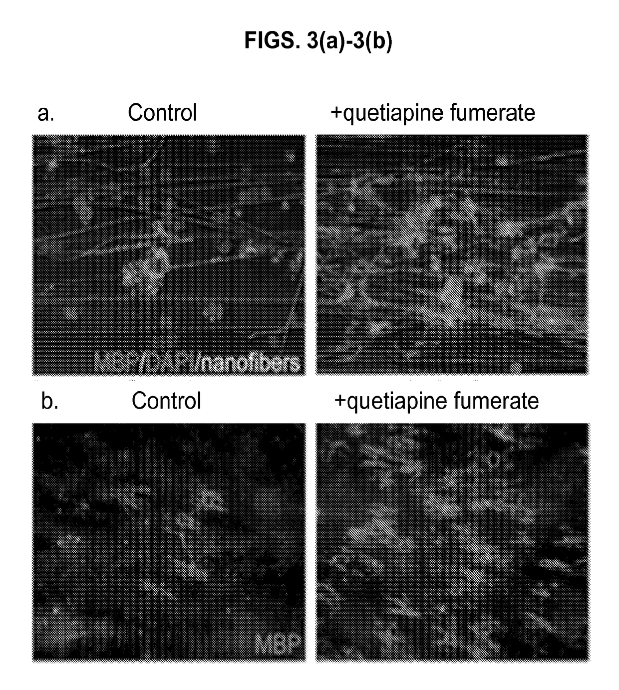 Micropillar arrays for assaying myelination