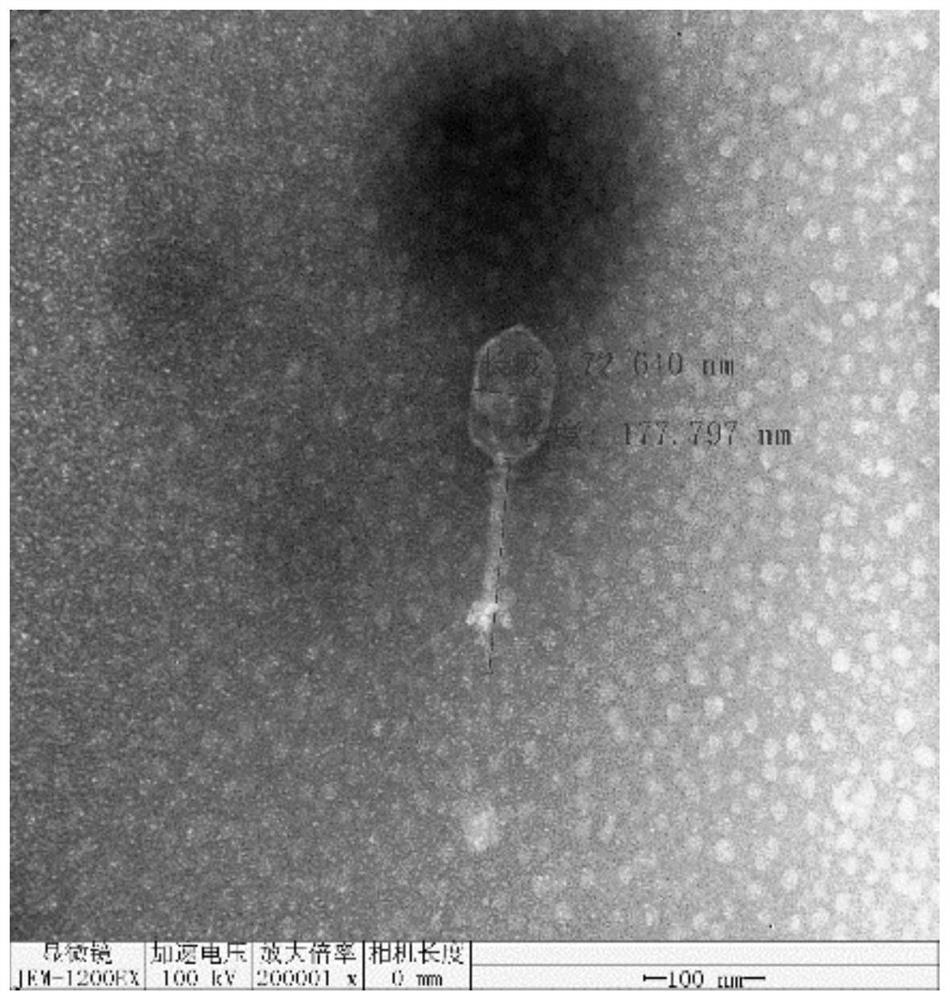 A highly lytic Klebsiella pneumoniae phage rdp-kp-20007 and its application