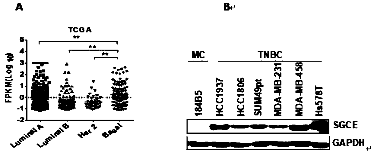 Application of SGCE gene as triple negative breast cancer marker