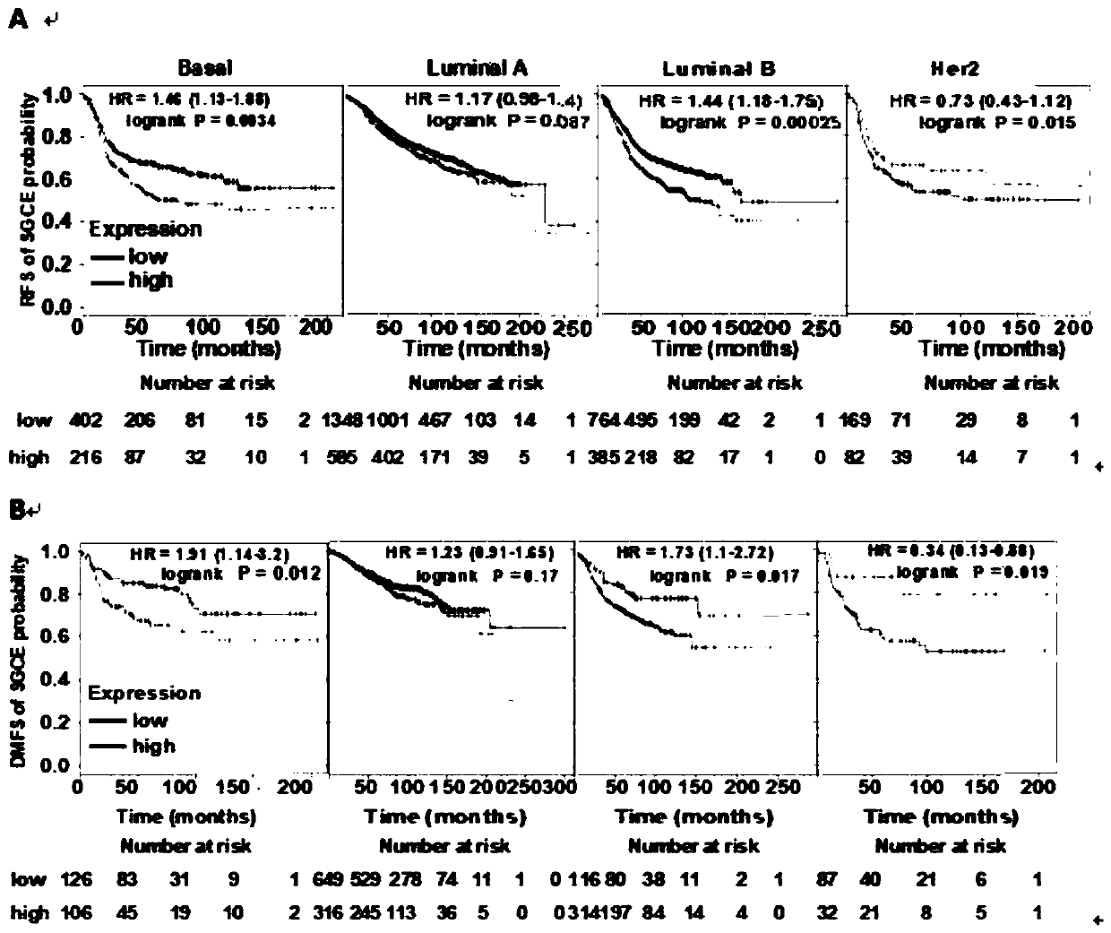 Application of SGCE gene as triple negative breast cancer marker