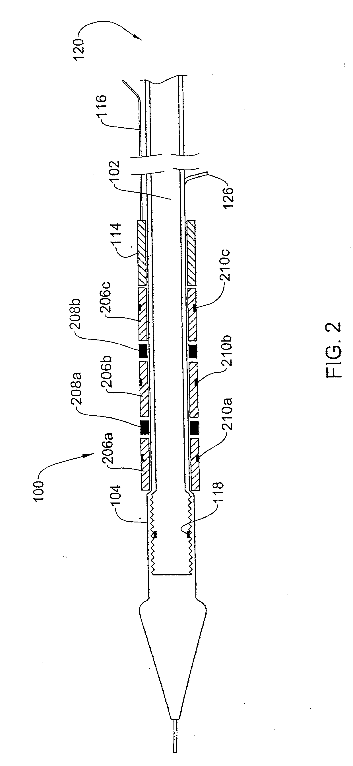 Balloon catheter for multiple adjustable-length stent deployment