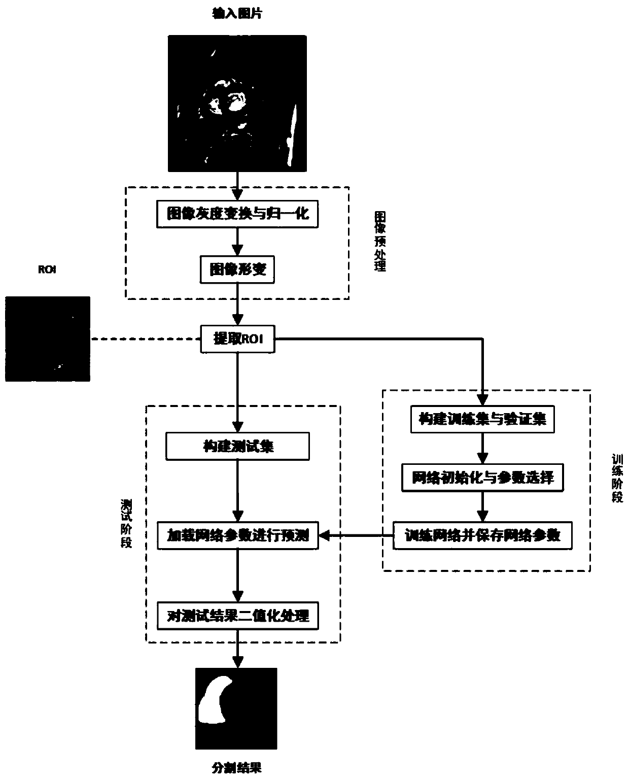 Automatic right ventricle segmentation method based on deep learnin