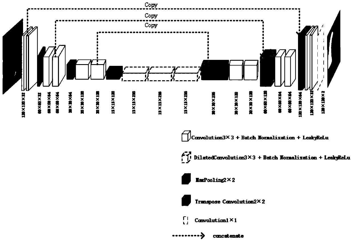 Automatic right ventricle segmentation method based on deep learnin