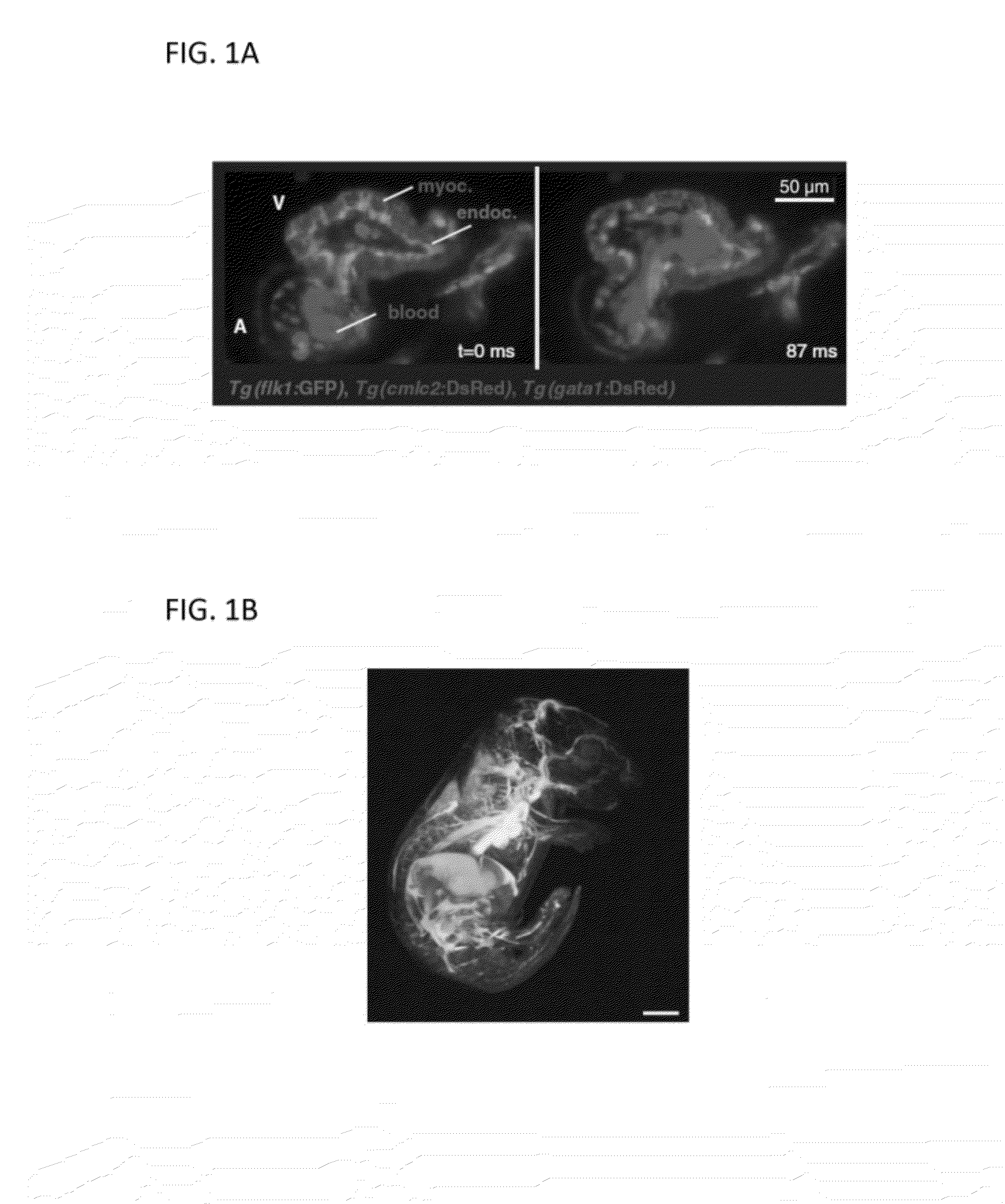 Simultaneous orthogonal light sheet microscopy and computed optical tomography