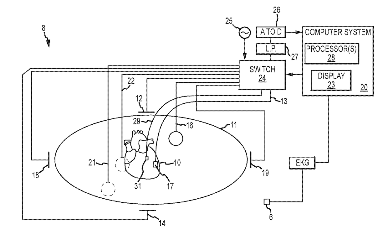 System and Method for Analyzing Biological Signals and Generating Electrophysiology Maps