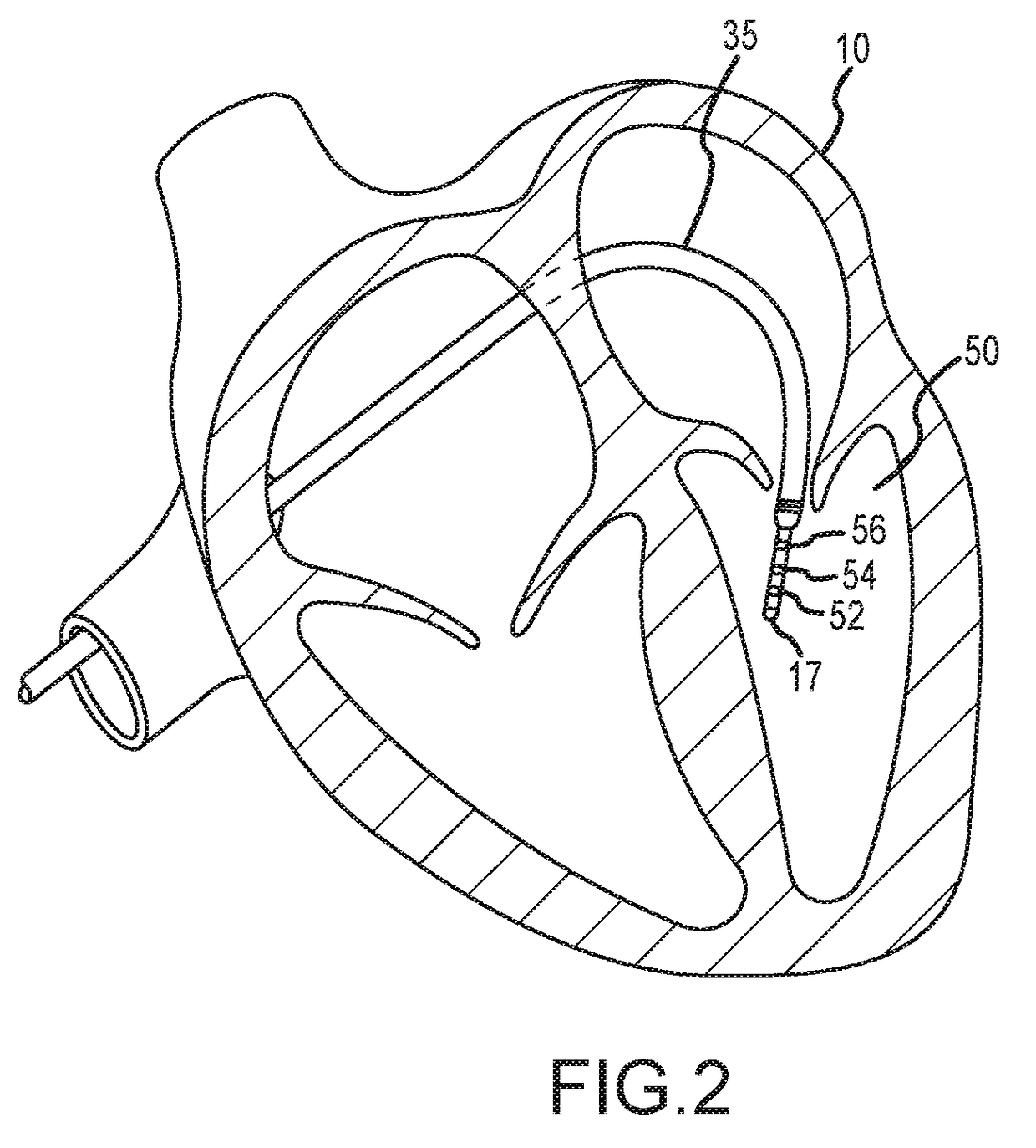 System and Method for Analyzing Biological Signals and Generating Electrophysiology Maps