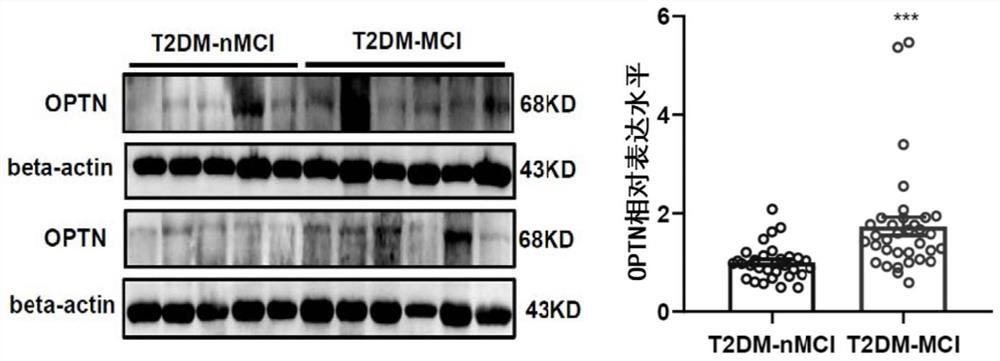 Biomarker and kit for predicting MCI risk of type 2 diabetes patients and application thereof