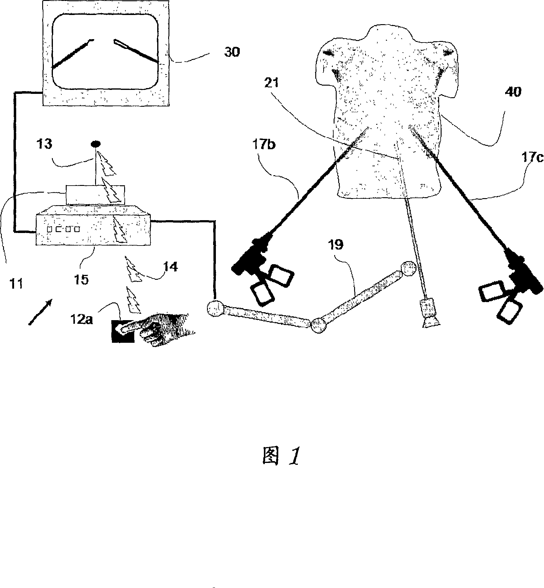 Means and methods of improving laparoscopic surgery