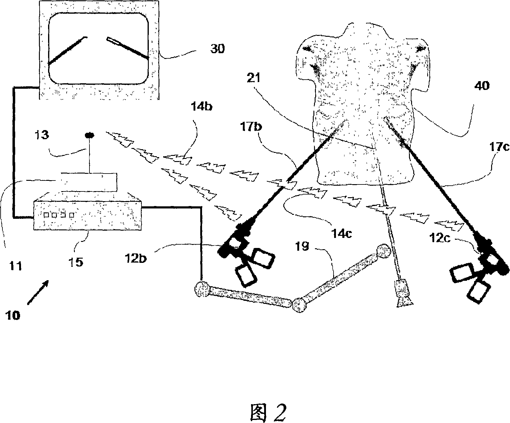 Means and methods of improving laparoscopic surgery