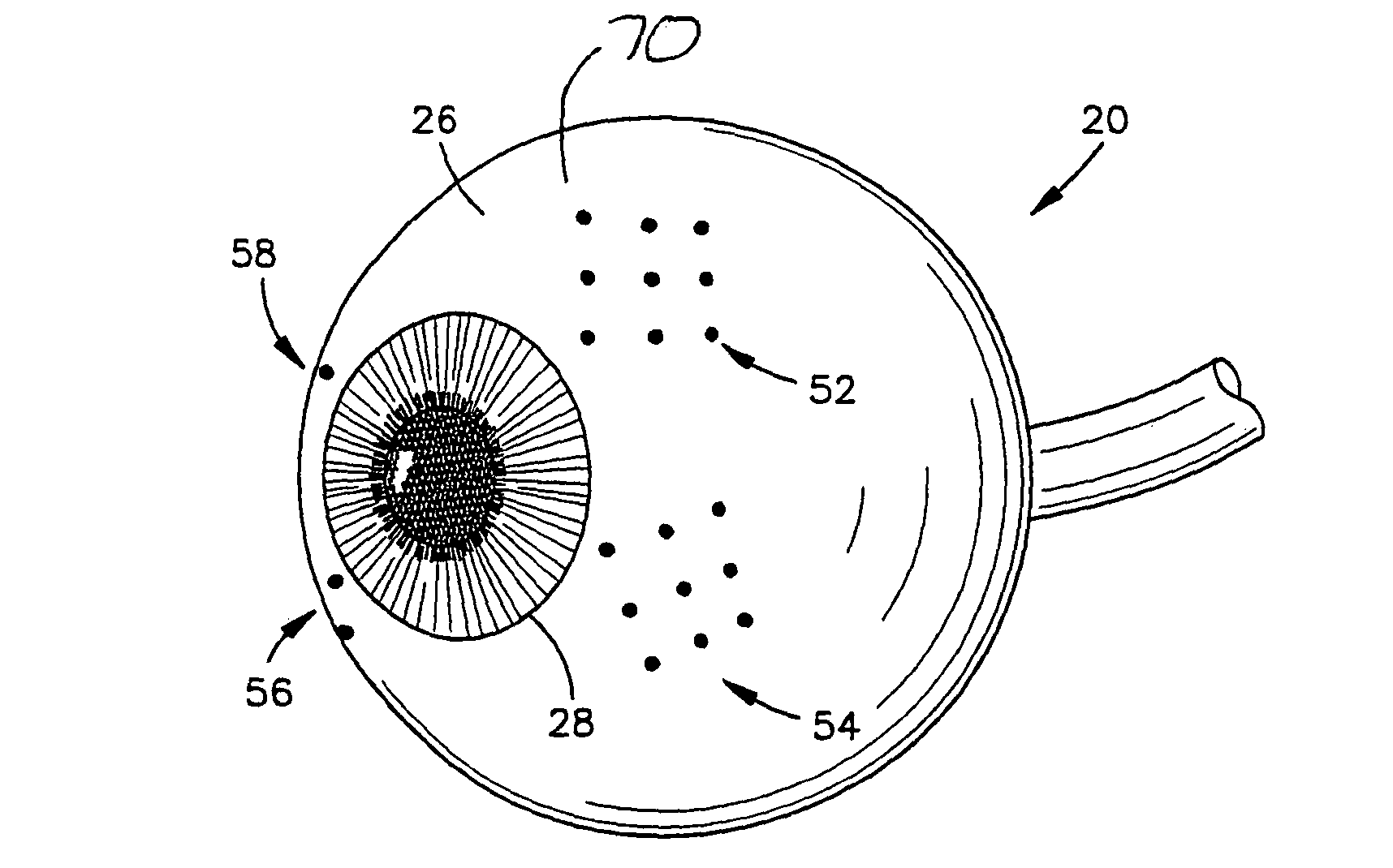 System and method for treating connective tissue