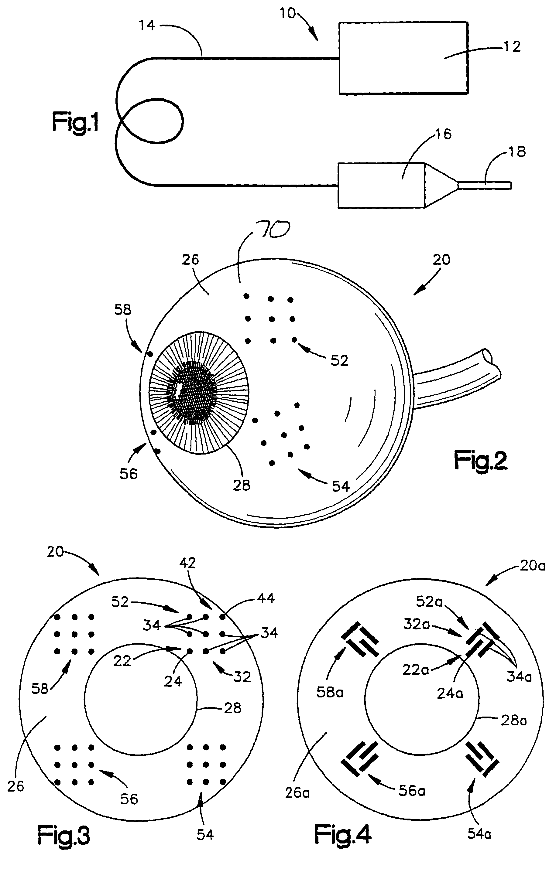 System and method for treating connective tissue