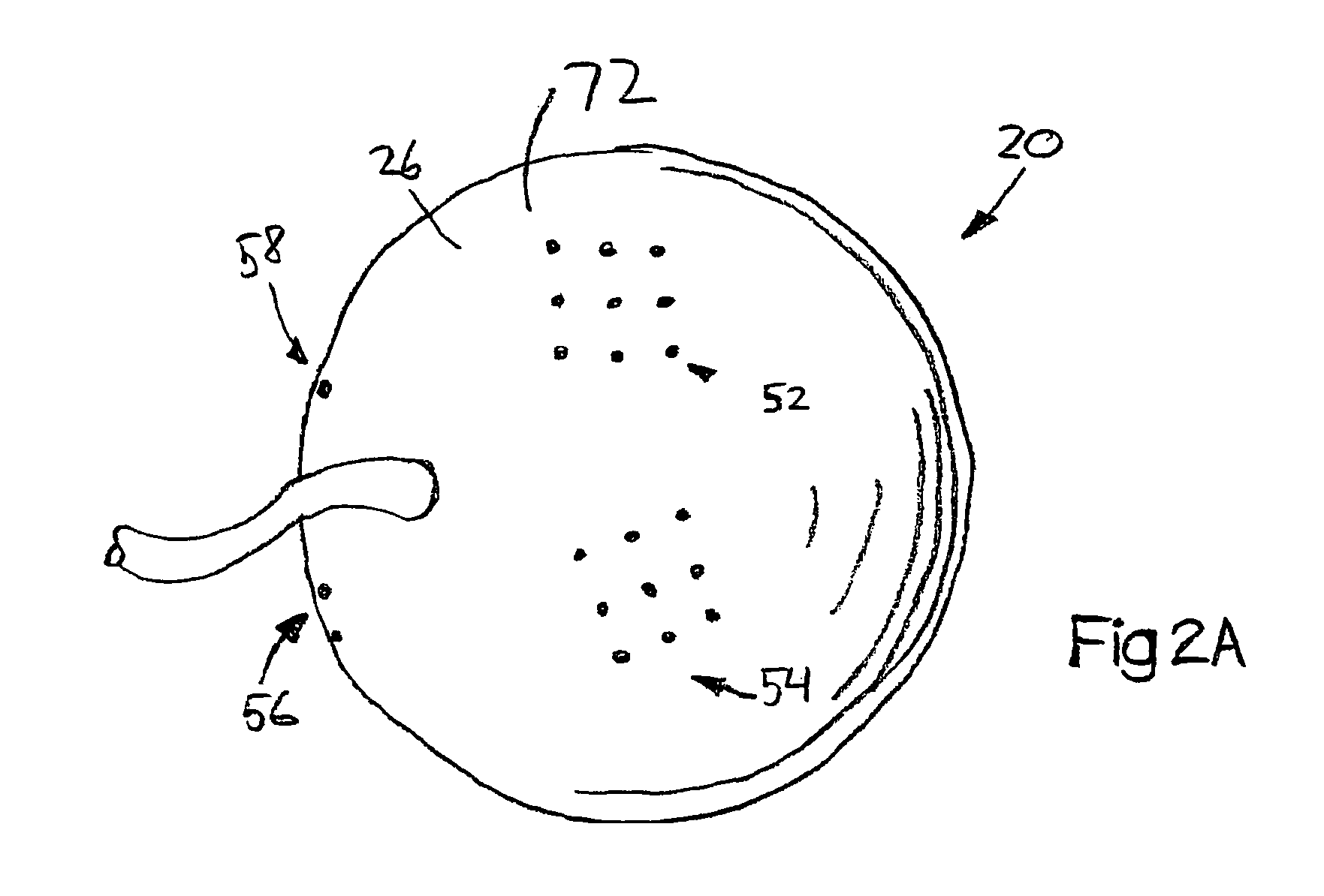 System and method for treating connective tissue