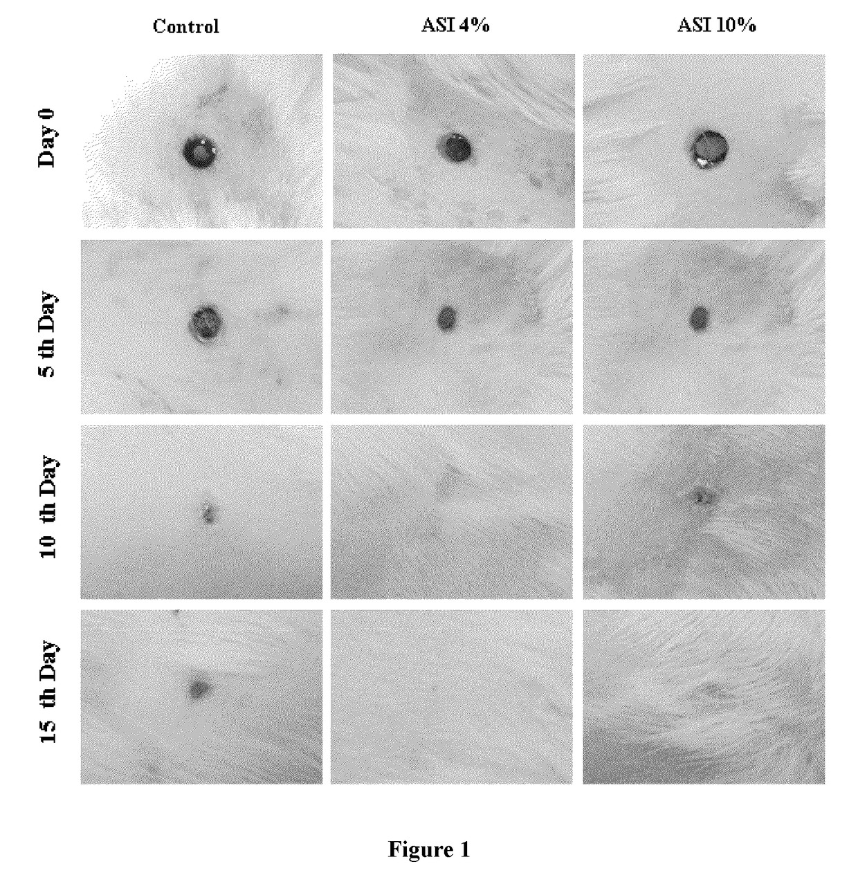 Topical arginine-silicate-inositol for wound healing