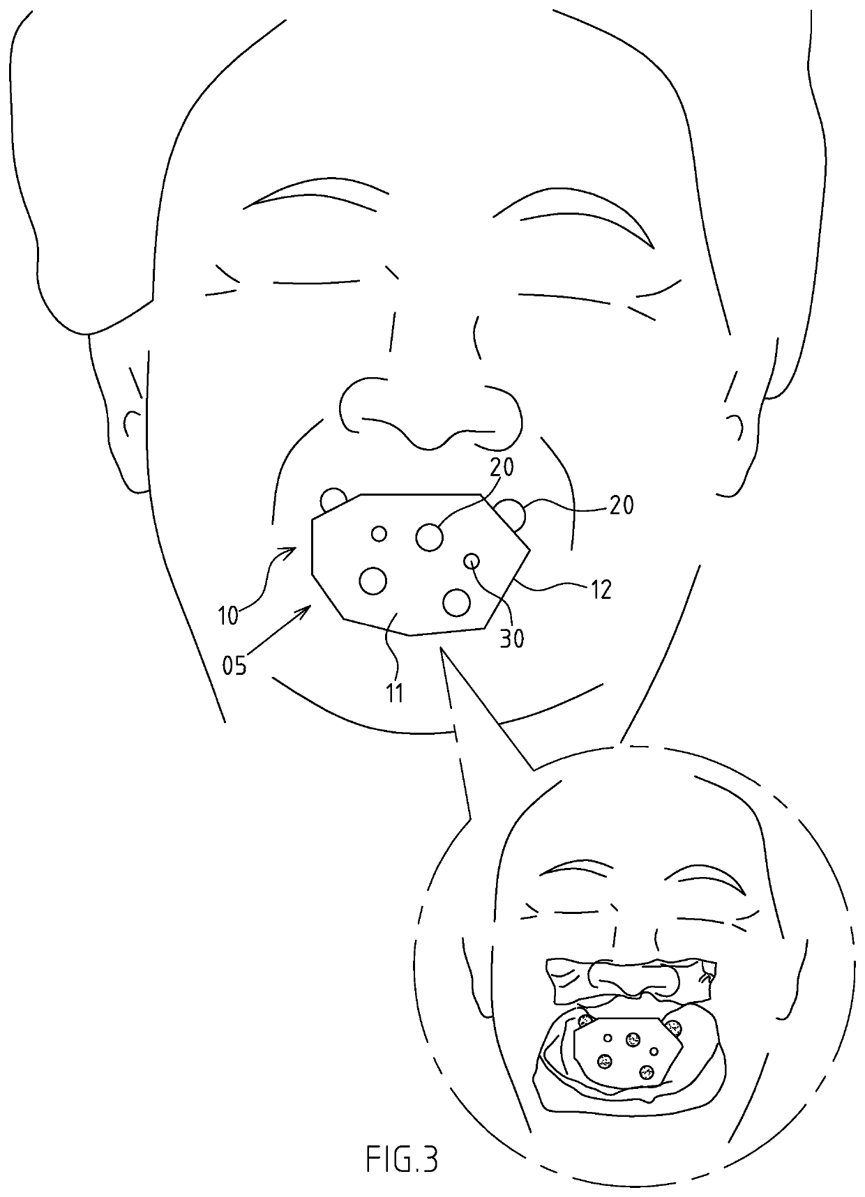 Face scanning and positioning structure used for full denture