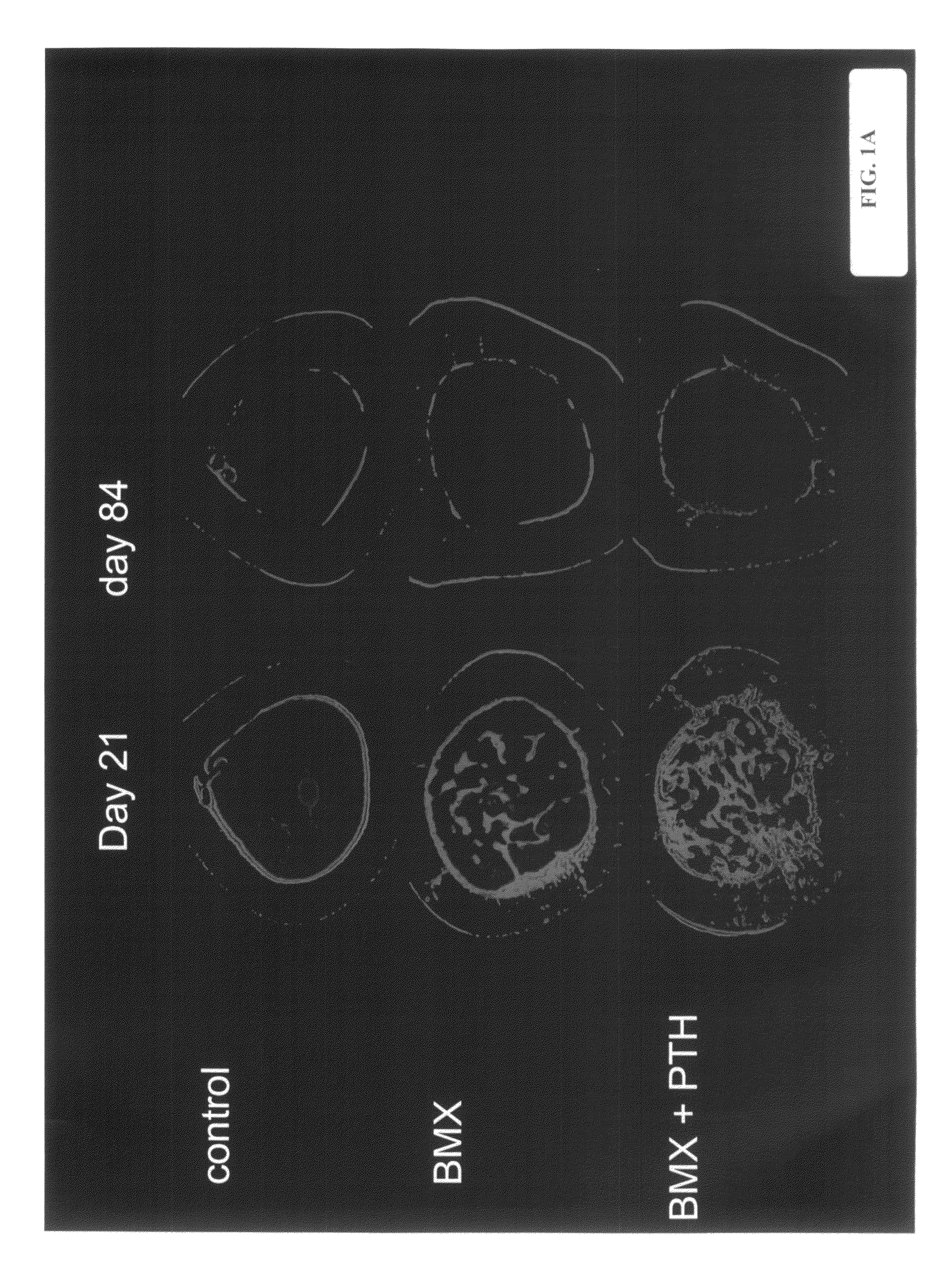 Methods and compositions for fostering and preserving bone growth