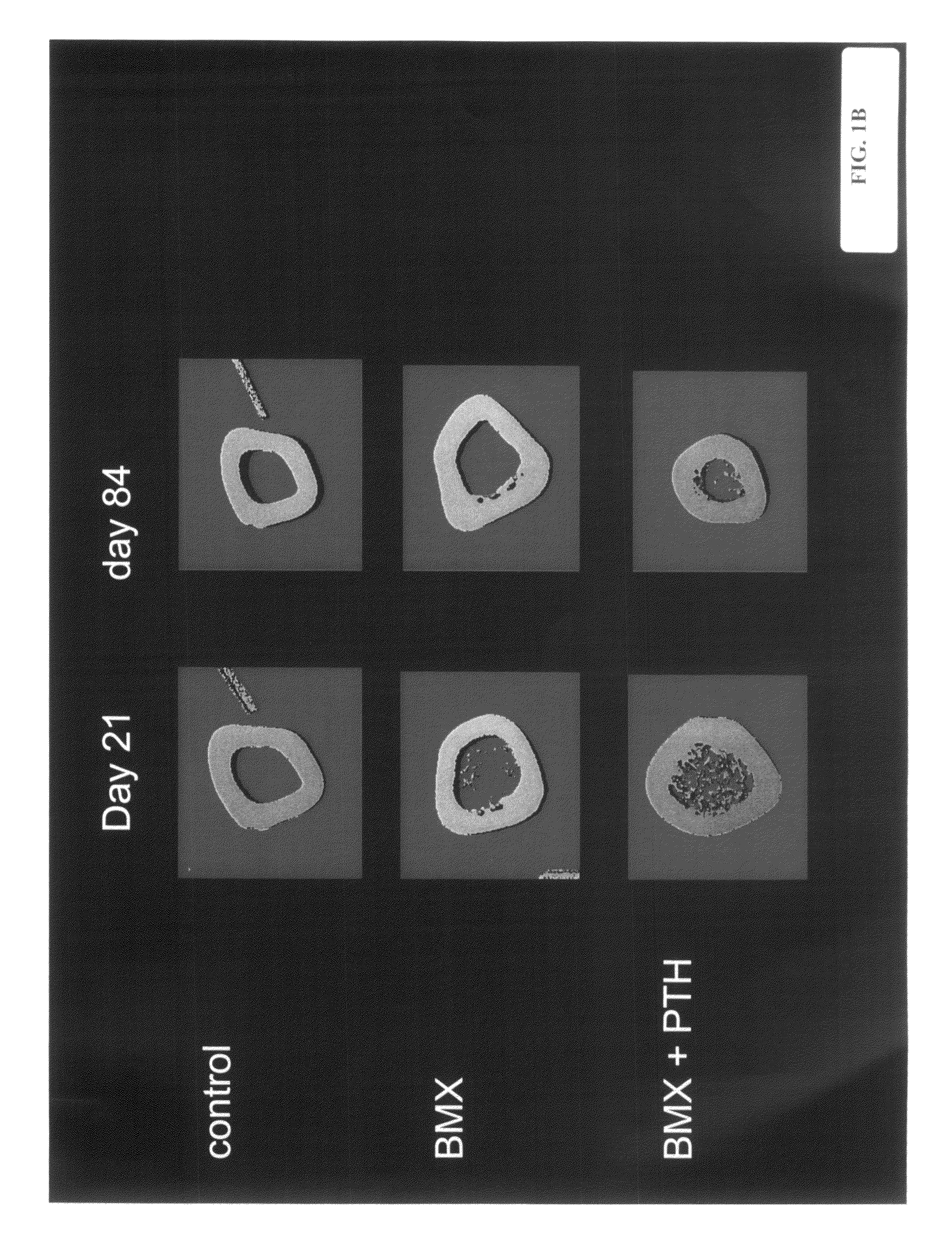 Methods and compositions for fostering and preserving bone growth