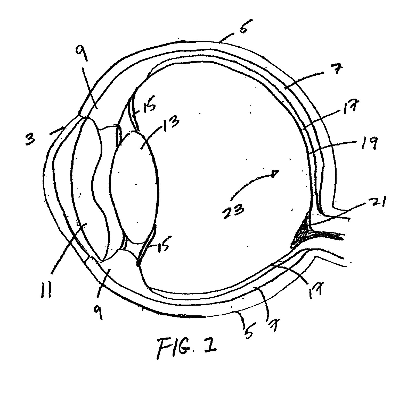 Ophthalmic instrument having an integral wavefront sensor and display device that displays a graphical representation of high order aberrations of the human eye measured by the wavefront sensor