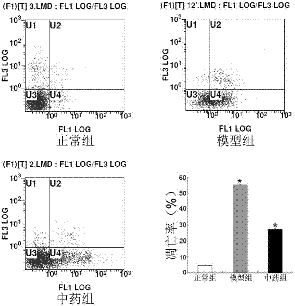 Traditional Chinese medicine composition and application thereof to preparation of drugs for treating pulmonary fibrosis diseases