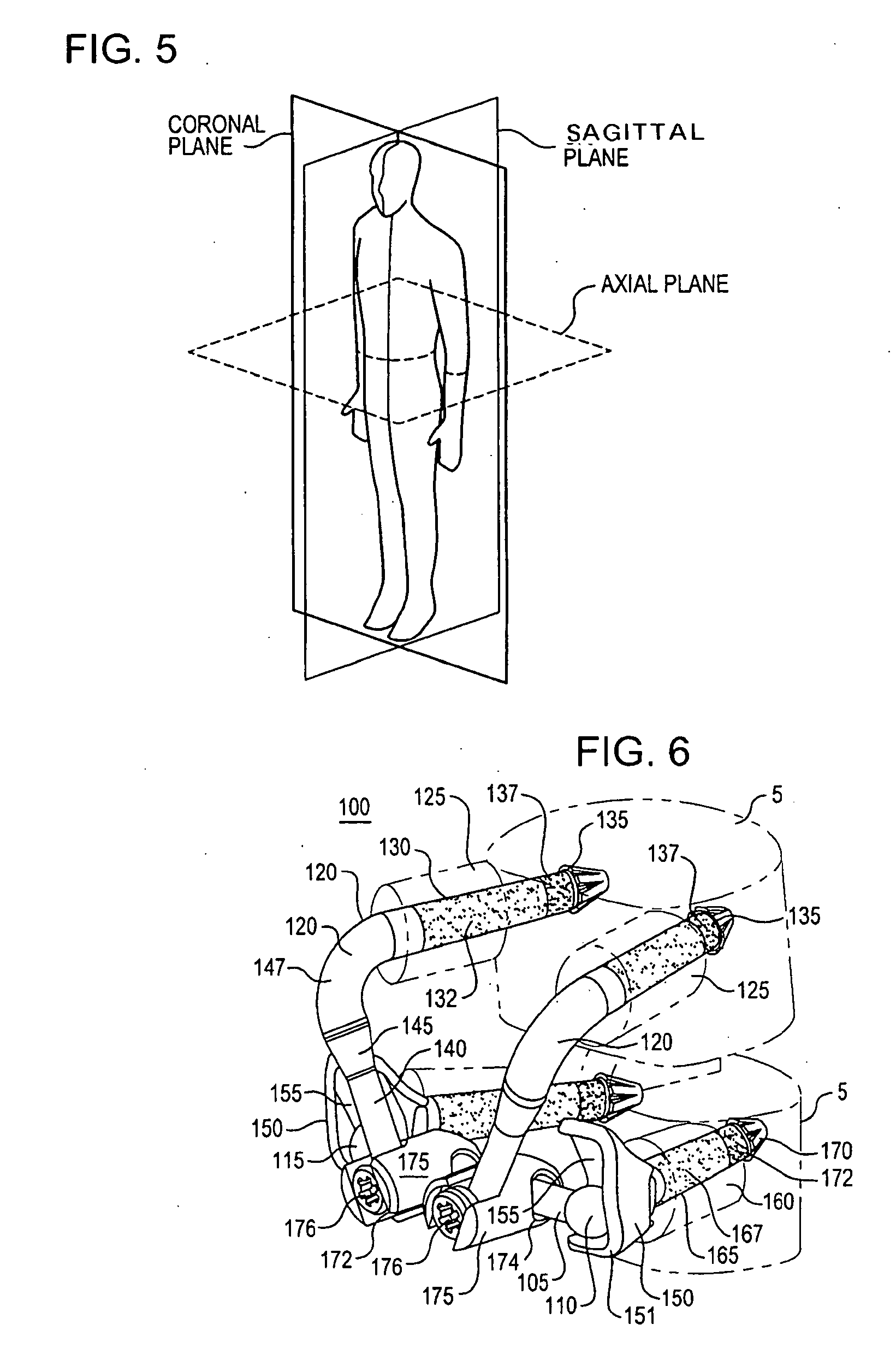 Crossbar spinal prosthesis having a modular design and related implantation methods