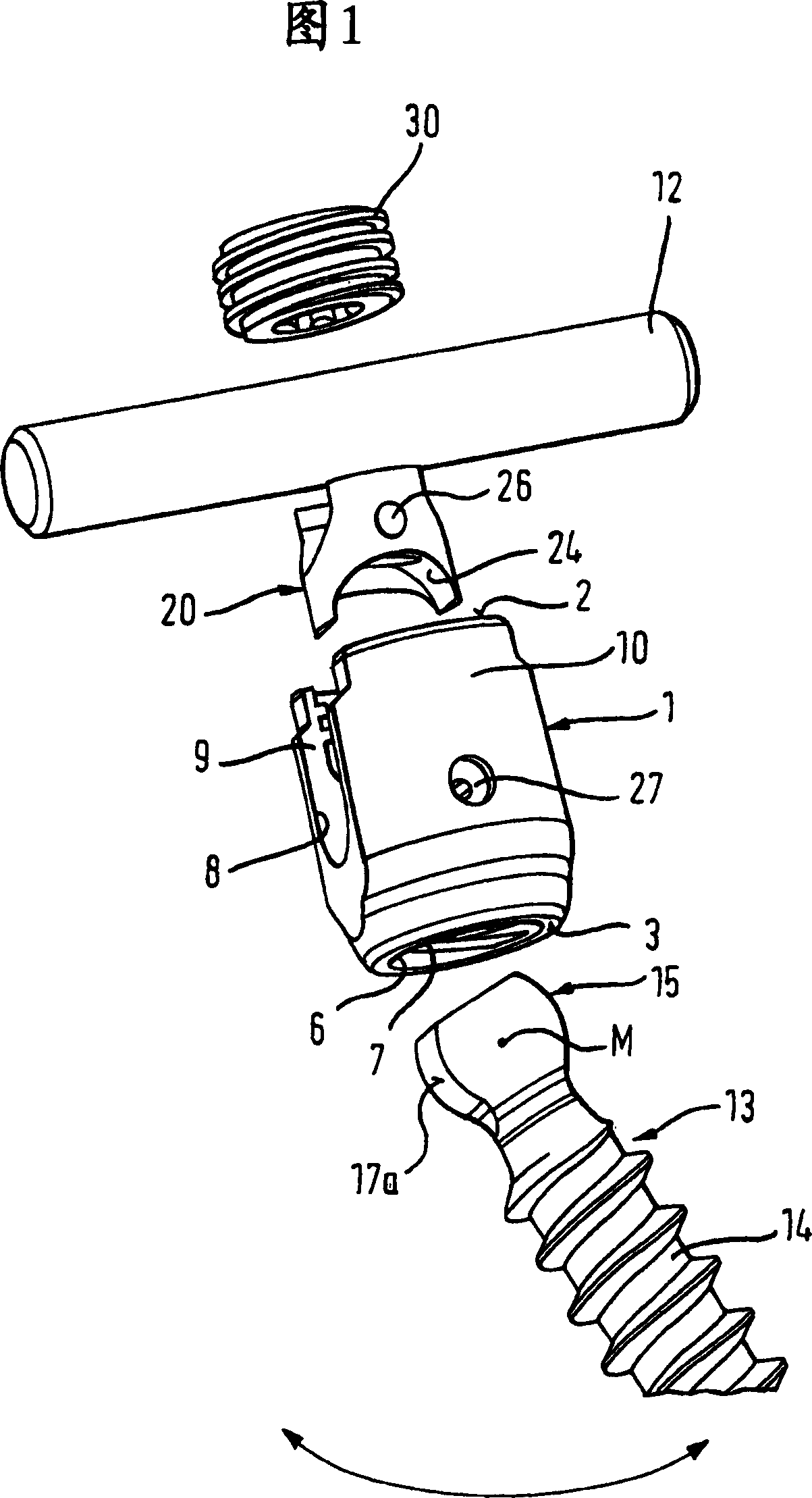 Bone anchoring device